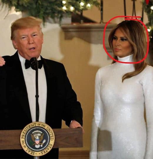 At Mar-a-Lago, Melania Trump Sparks Cosmetic Surgery Rumors