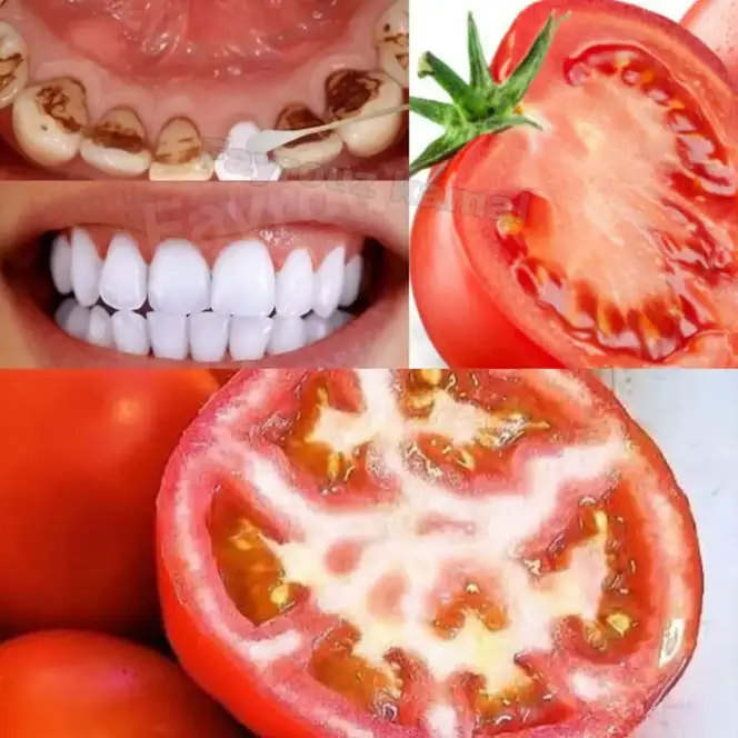 Use tomato teeth whitening to naturally brighten your smile.