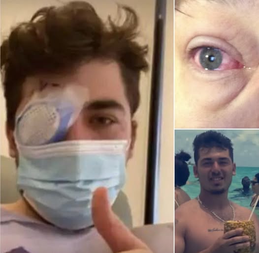 Man goes blind after sleeping with contact lenses