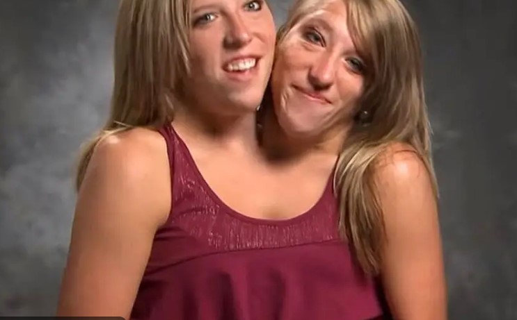 Abby and Brittany Hensel: The world’s most famous conjoined twins are now 5th grade teachers