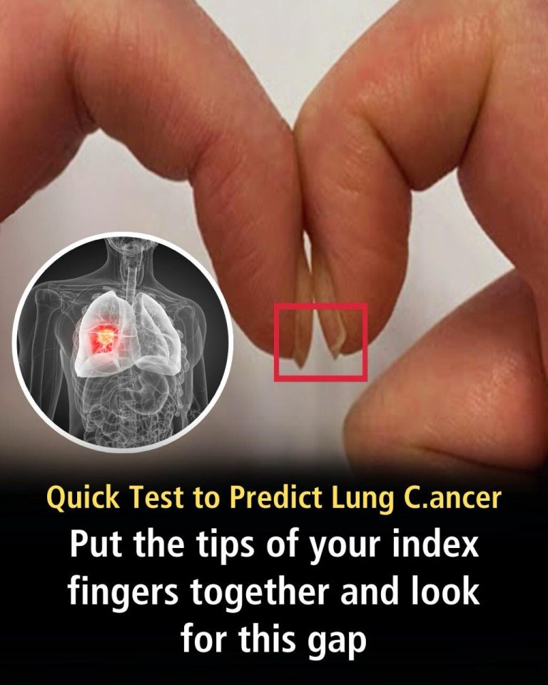 Doctor-approved finger test warns of serious health conditions
