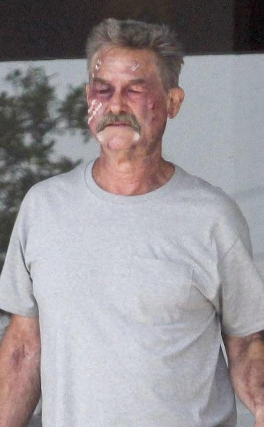 Please pray for Kurt Russell, What happened to him is horrific