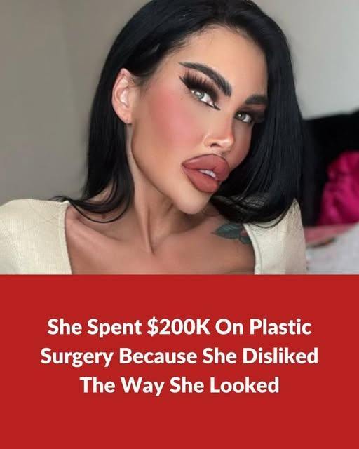 Plastic surgery addict spends $200K on plastic surgery